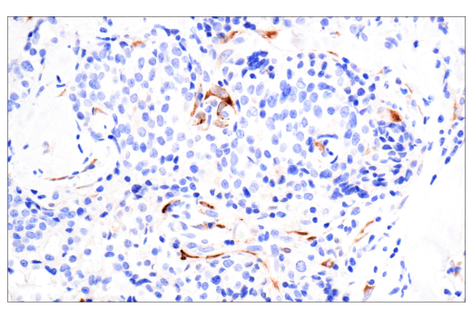 Immunohistochemistry Image 2: TIMP1 (D10E6) Rabbit Monoclonal Antibody