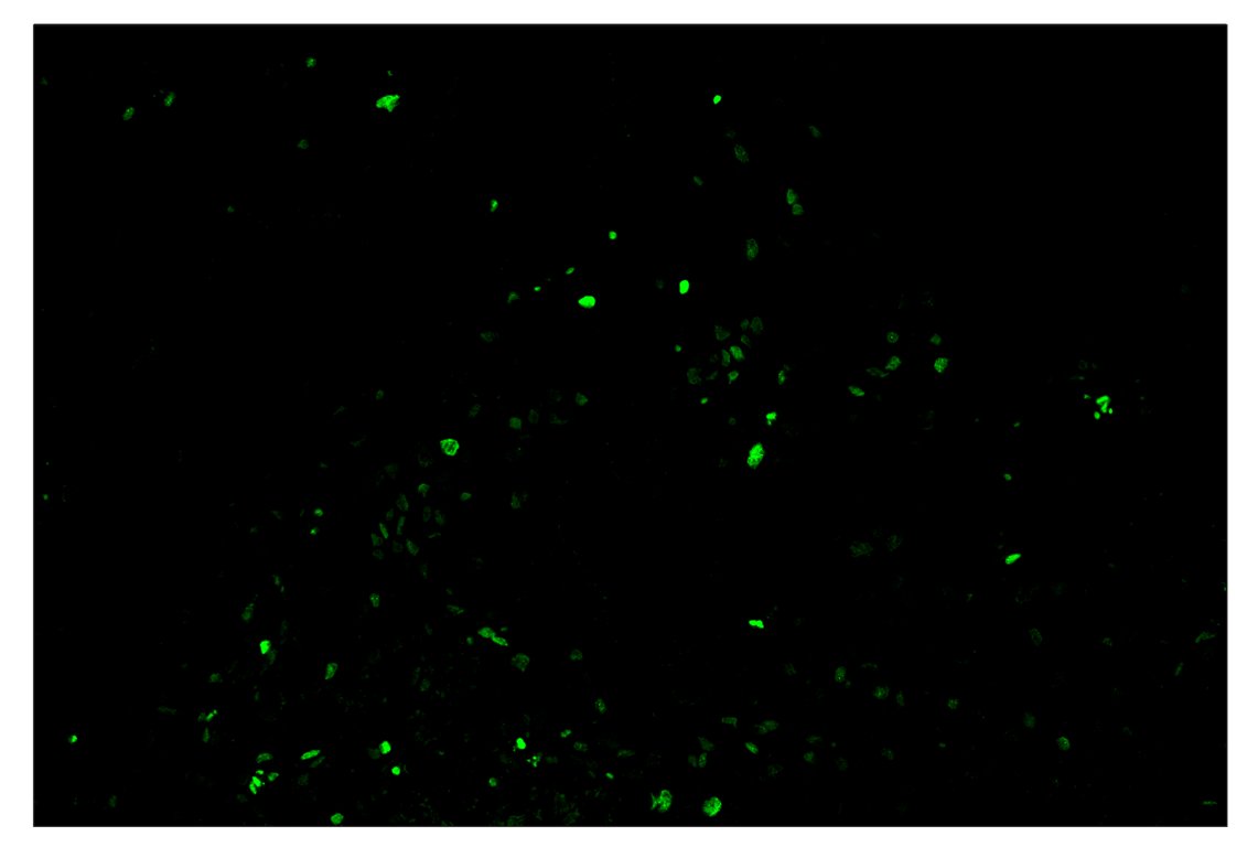 Immunohistochemistry Image 2: Phospho-Histone H2A.X (Ser139) (D7T2V) & CO-0135-488 SignalStar<sup>™</sup> Oligo-Antibody Pair