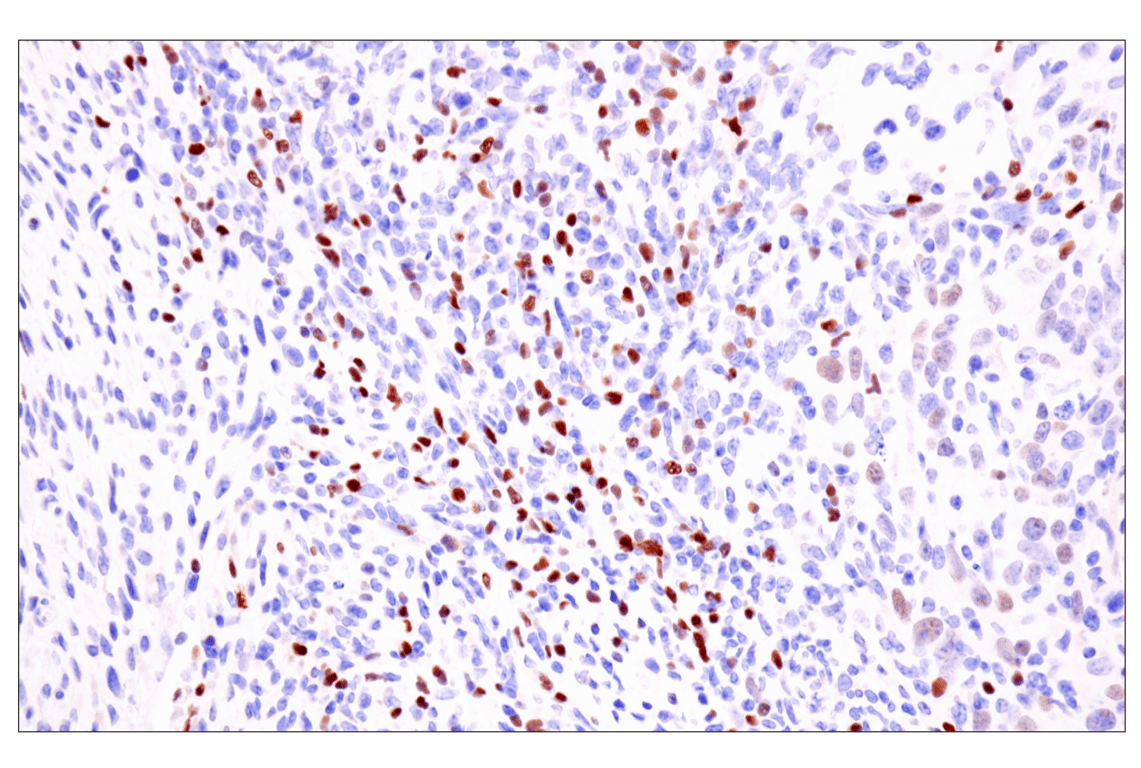 Immunohistochemistry Image 8: TCF1/TCF7 (E6O1K) Rabbit Monoclonal Antibody