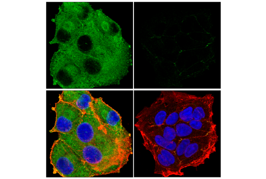 Immunofluorescence Image 2: PAK4 (E7H7R) Rabbit Monoclonal Antibody