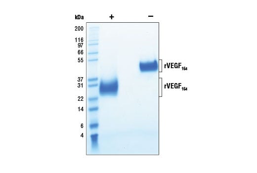undefined Image 2: Rat Vascular Endothelial Growth Factor-164 (rVEGF<sub>164</sub> )