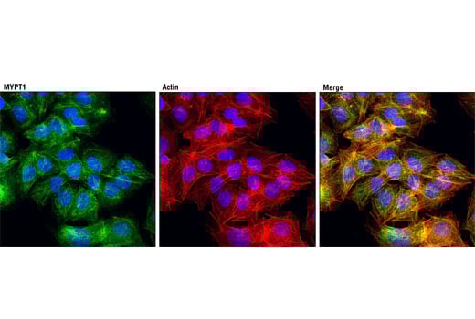 Immunofluorescence Image 1: MYPT1 (D6C1) Rabbit Monoclonal Antibody