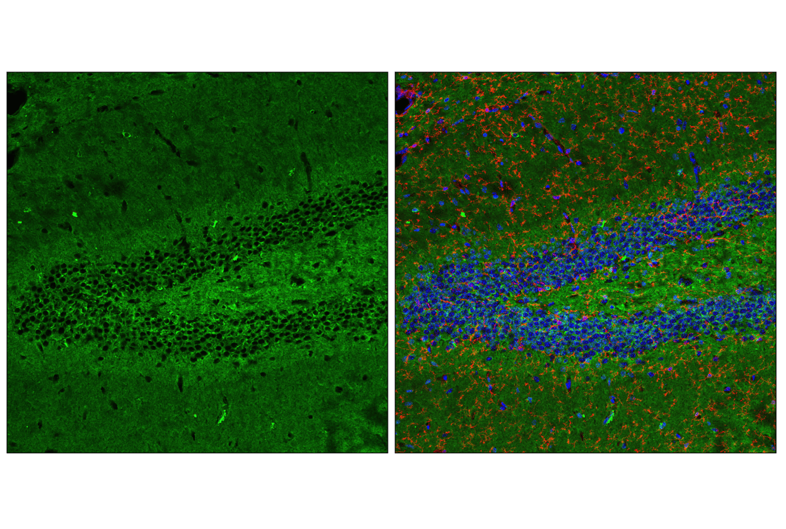 undefined Image 49: Pathological Hallmarks of Alzheimer's Disease Antibody Sampler Kit