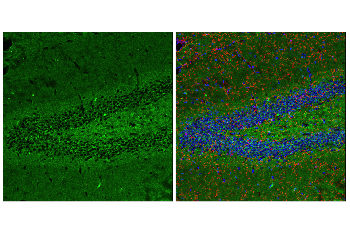 undefined Image 12: PhosphoPlus<sup>®</sup> Tau (Ser396) Antibody Duet