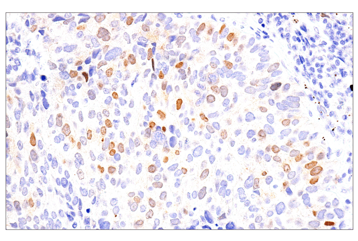 Immunohistochemistry Image 3: Chk1 (2G1D5) Mouse Monoclonal Antibody (BSA and Azide Free)