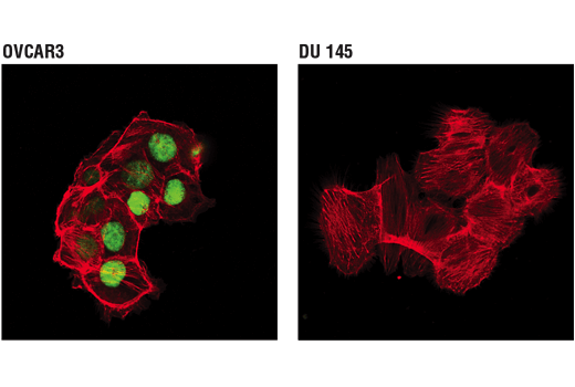 Immunofluorescence Image 1: WT1 (D8I7F) Rabbit Monoclonal Antibody (BSA and Azide Free)
