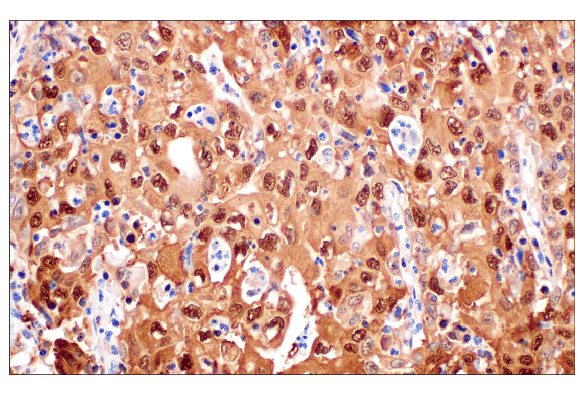 SERPINB3 (F3Z8E) Rabbit Monoclonal Antibody | Cell Signaling
