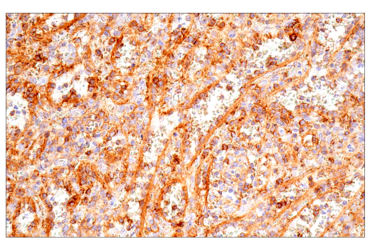 Immunohistochemistry Image 10: CD99 (PCB1) Mouse mAb