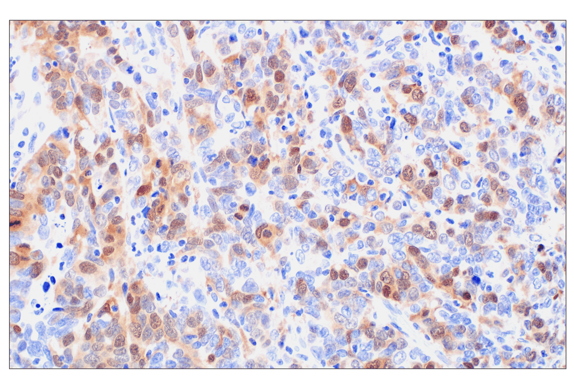 Immunohistochemistry Image 6: PBK/TOPK (F2X2Z) Rabbit Monoclonal Antibody