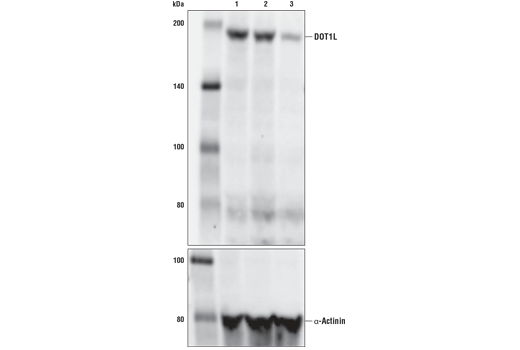 Western Blotting Image 2: DOT1L (D1W4Z) Rabbit Monoclonal Antibody