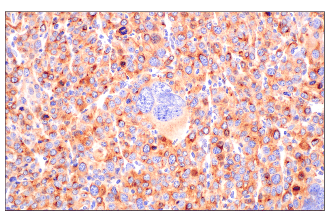 Immunohistochemistry Image 1: CD10/Neprilysin (F4P6H) Rabbit Monoclonal Antibody