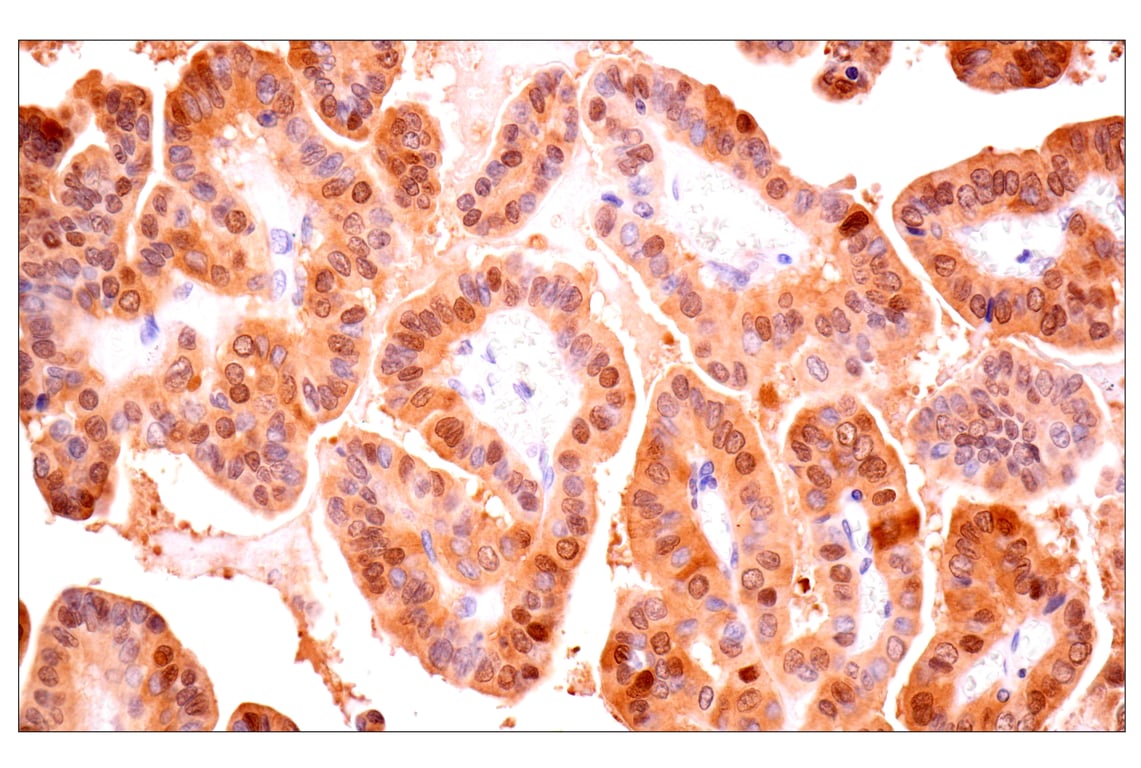Immunohistochemistry Image 1: ACBP/DBI (E4V8V) Rabbit Monoclonal Antibody