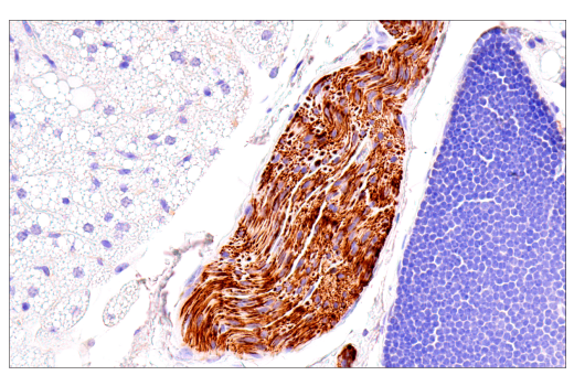 Immunohistochemistry Image 7: Neurofilament-M (E7L2T) Rabbit Monoclonal Antibody