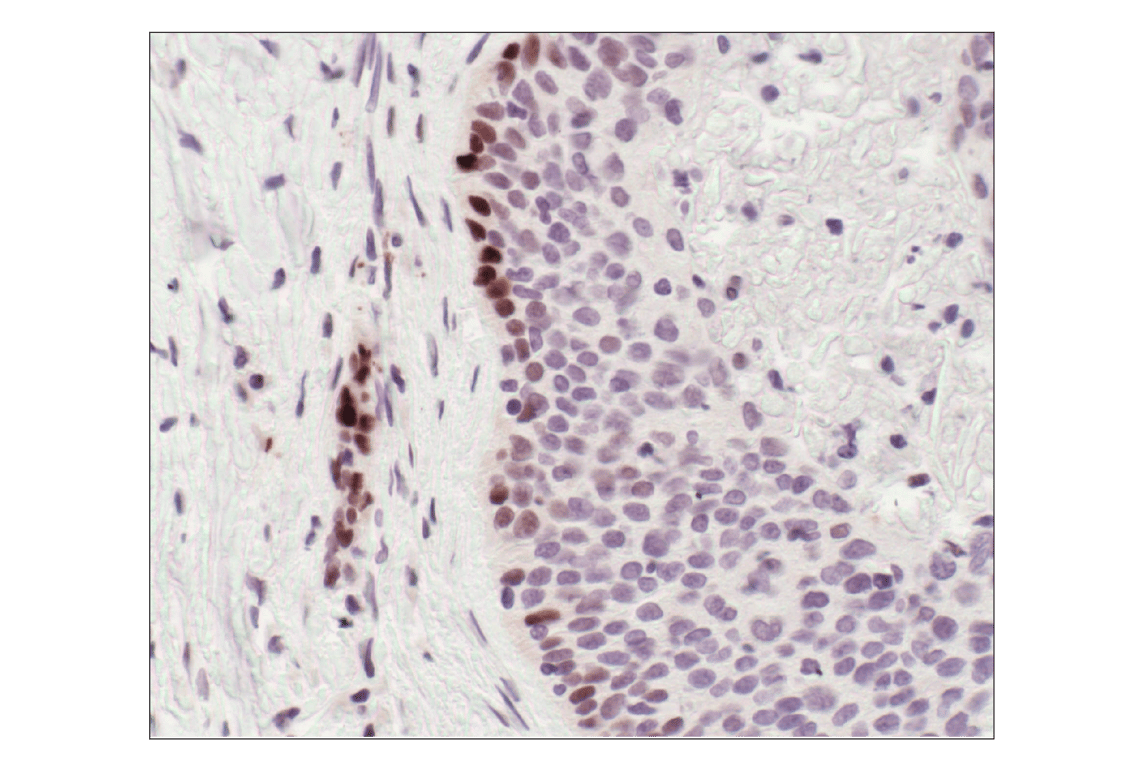 Immunohistochemistry Image 2: Phospho-Stat3 (Tyr705) (D3A7) XP<sup>®</sup> Rabbit mAb (BSA and Azide Free)