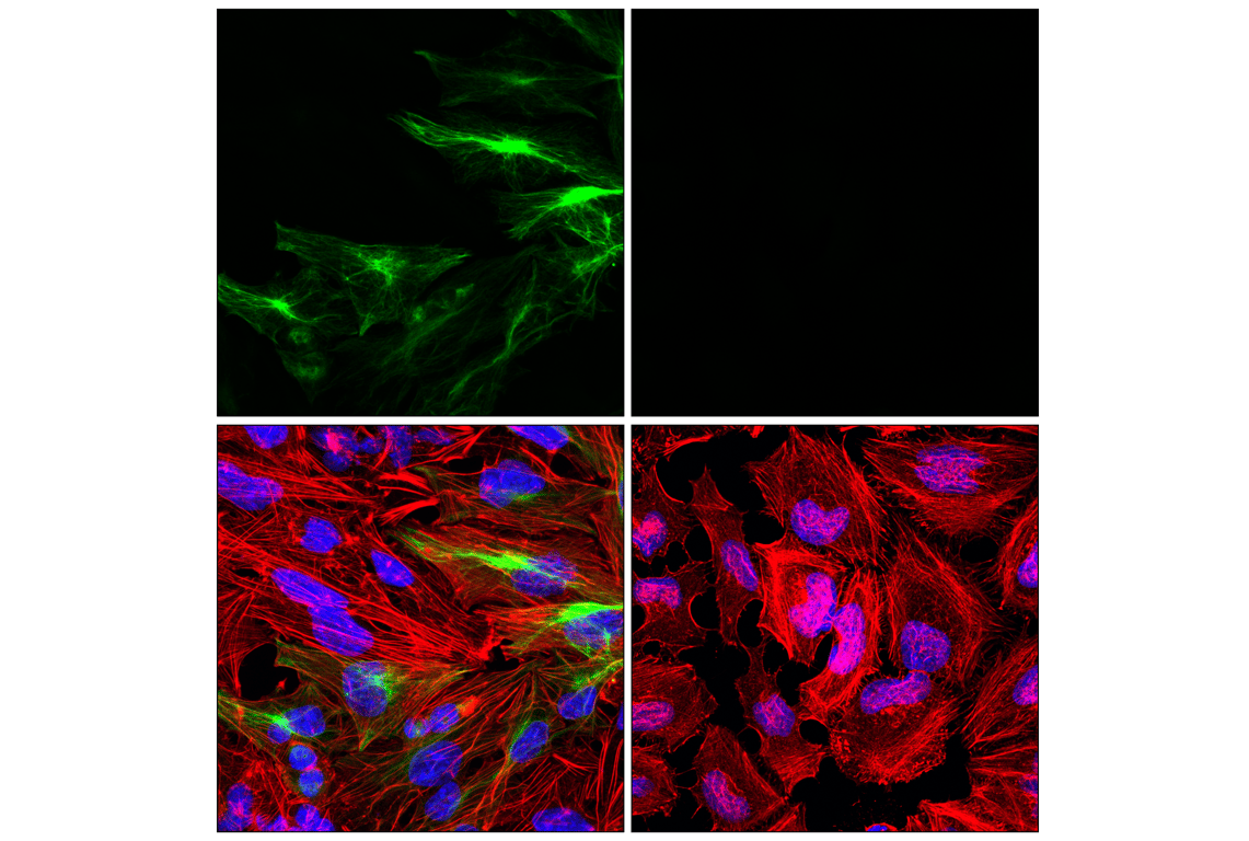 Immunofluorescence Image 1: GFAP (E4L7M) Rabbit Monoclonal Antibody (Alexa Fluor<sup>®</sup> 488 Conjugate)