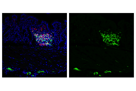 Immunofluorescence Image 3: IL-2R alpha/CD25 (E9W2J) Rabbit Monoclonal Antibody (BSA and Azide Free)