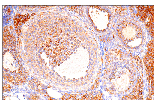 Immunohistochemistry Image 12: SDHB (E3H9Z) Rabbit Monoclonal Antibody
