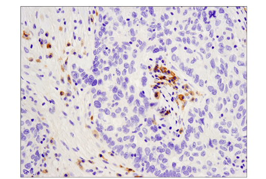 Immunohistochemistry Image 1: CD19 (Intracellular Domain) (D4V4B) Rabbit Monoclonal Antibody