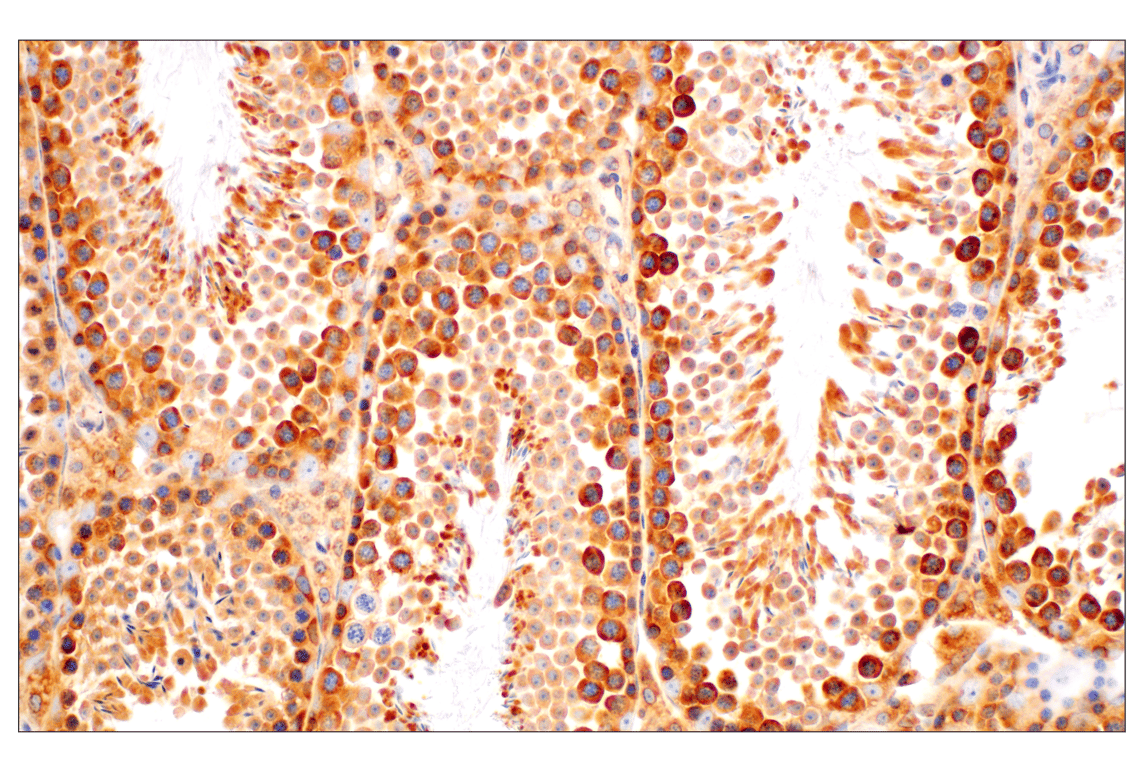 Immunohistochemistry Image 9: RACK1 (D59D5) Rabbit Monoclonal Antibody