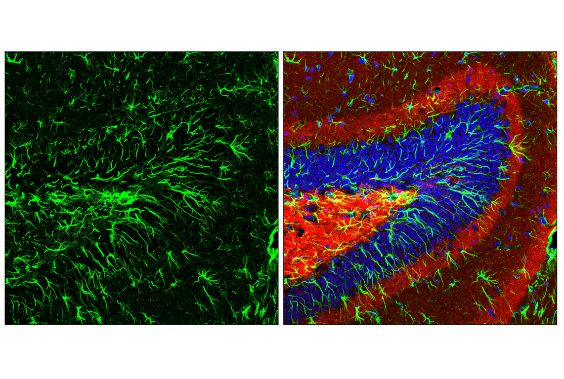 Immunofluorescence Image 1: GFAP (E4L7M) Rabbit Monoclonal Antibody (Alexa Fluor<sup>®</sup> 488 Conjugate)