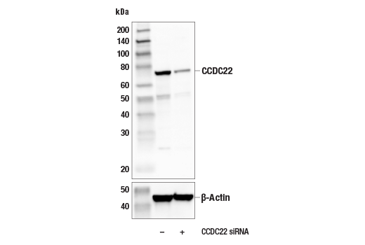 Western Blotting Image 2: CCDC22 (E3F5L) Rabbit Monoclonal Antibody