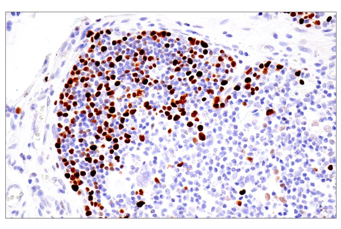 Immunohistochemistry Image 10: UHRF1 (E5W8W) Rabbit Monoclonal Antibody