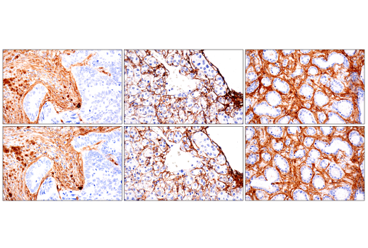 Immunohistochemistry Image 3: COL1A1 (E8F4L) Rabbit Monoclonal Antibody