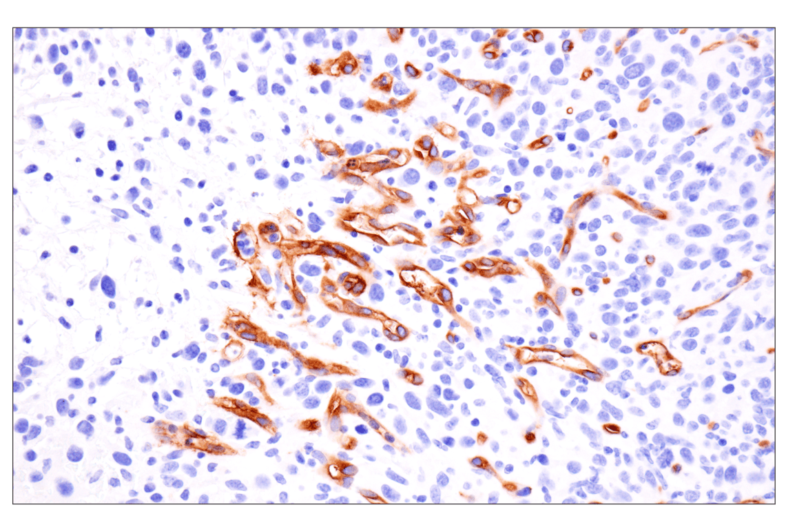 Immunohistochemistry Image 1: ESAM (F9D9P) Rabbit Monoclonal Antibody