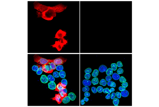 Immunofluorescence Image 1: His-Tag (D3I1O) XP<sup>®</sup> Rabbit mAb (Alexa Fluor<sup>®</sup> 555 Conjugate)