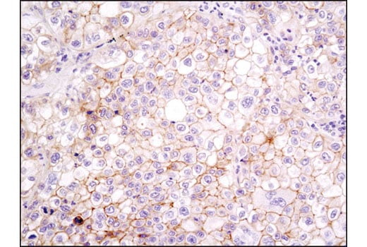Immunohistochemistry Image 3: Integrin beta1 (D2E5) Rabbit Monoclonal Antibody (BSA and Azide Free)