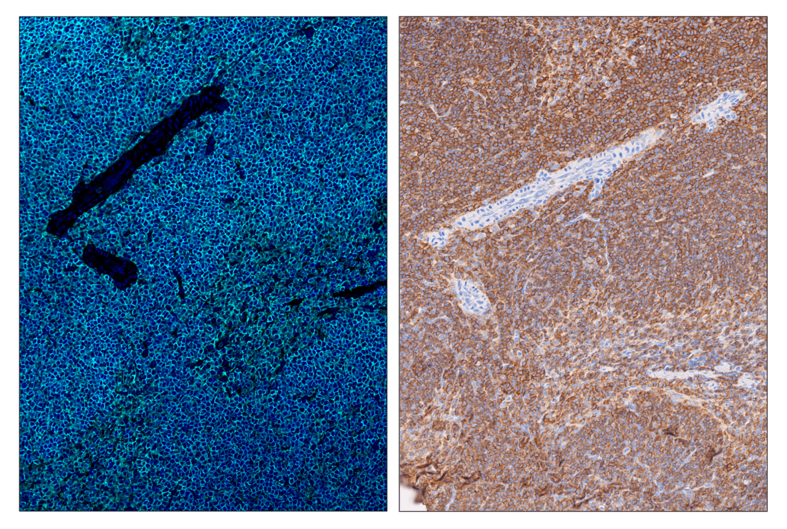 Immunohistochemistry Image 6: CD45 (D3F8Q) & CO-0046-750 SignalStar<sup>™</sup> Oligo-Antibody Pair