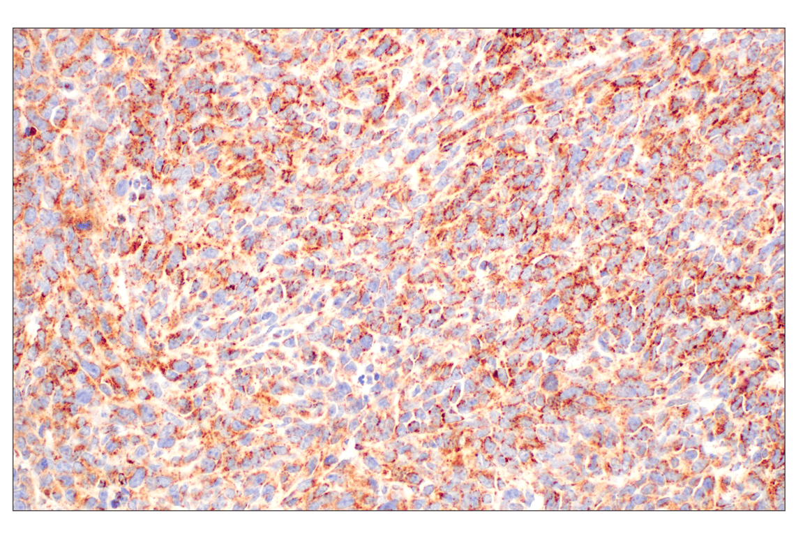 Immunohistochemistry Image 9: GOT2 (F4P3R) Rabbit Monoclonal Antibody