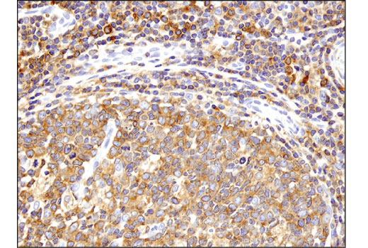 Immunohistochemistry Image 3: Kindlin-3 (D8I7V) Rabbit Monoclonal Antibody