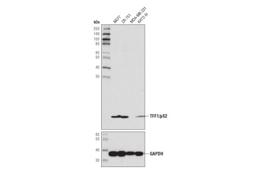 Western Blotting Image 2: TFF1/pS2 (D2Y1J) Rabbit Monoclonal Antibody