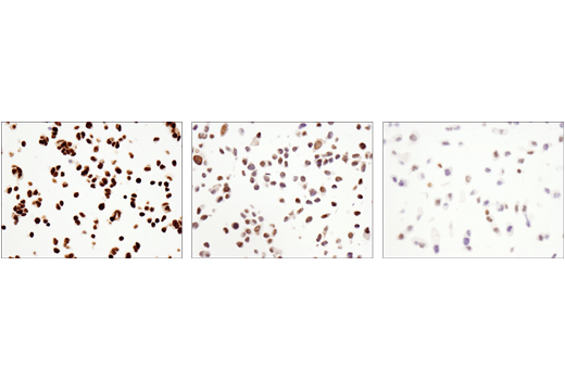 Immunohistochemistry Image 2: DNMT3A (D23G1) Rabbit Monoclonal Antibody