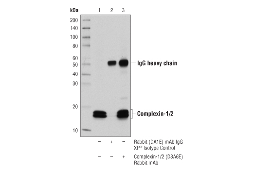 undefined Image 22: Presynaptic Vesicle Cycle Antibody Sampler Kit