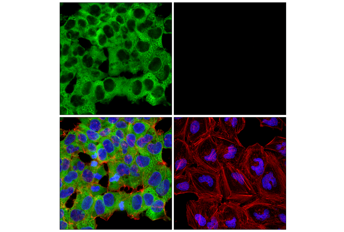 Immunofluorescence Image 1: LIN28A (D84C11) Rabbit Monoclonal Antibody