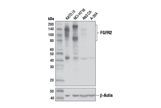 Western Blotting Image 3: FGF Receptor 2 (D4H9) Rabbit Monoclonal Antibody