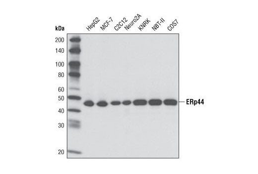 Western Blotting Image 1: ERp44 (D17A6) XP<sup>®</sup> Rabbit mAb