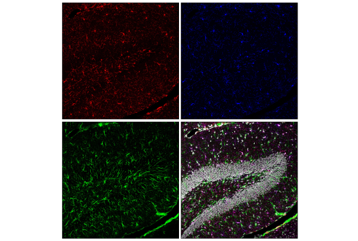 Immunofluorescence Image 3: CSF-1R/M-CSF-R (E6W9F) Rabbit Monoclonal Antibody