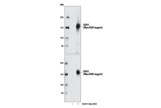 Western Blotting Image 2: SSH1 (E1K3W) Rabbit Monoclonal Antibody