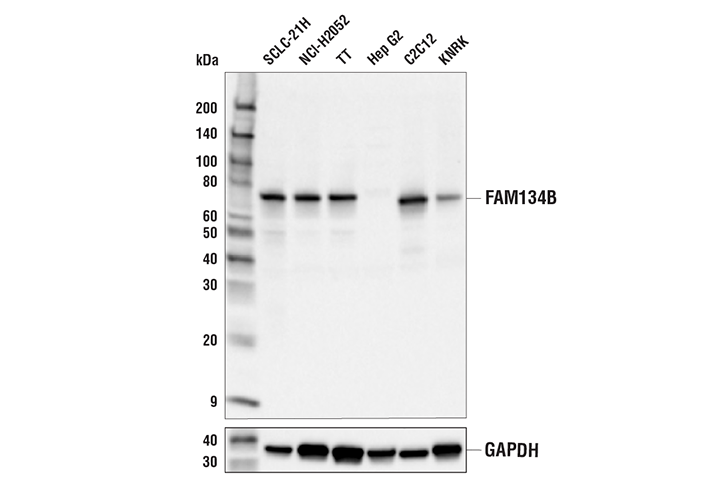 undefined Image 9: ER-phagy Cargo Receptor Antibody Sampler Kit