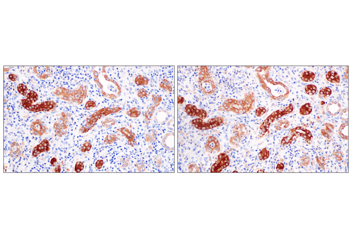 Immunohistochemistry Image 10: SHMT1 (F5Q3S) Rabbit Monoclonal Antibody