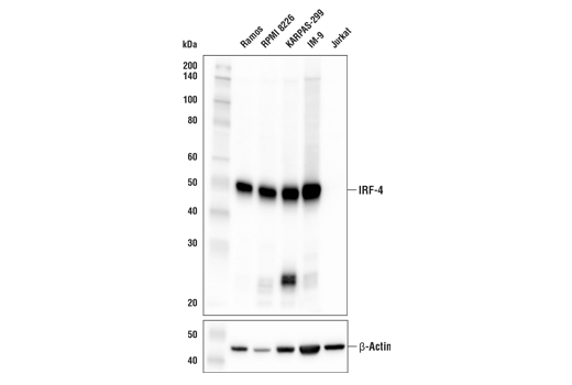 Western Blotting Image 1: IRF-4 (E8H3S) XP® Rabbit mAb