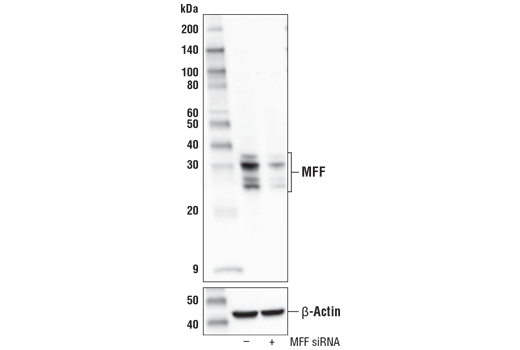 Western Blotting Image 1: MFF (E5W4M) XP<sup>®</sup> Rabbit mAb