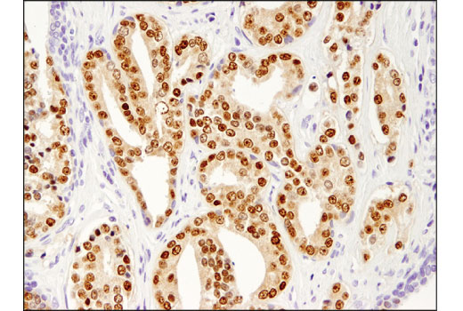 Immunohistochemistry Image 3: NKX3.1 (D6D2Z) Rabbit Monoclonal Antibody (BSA and Azide Free)