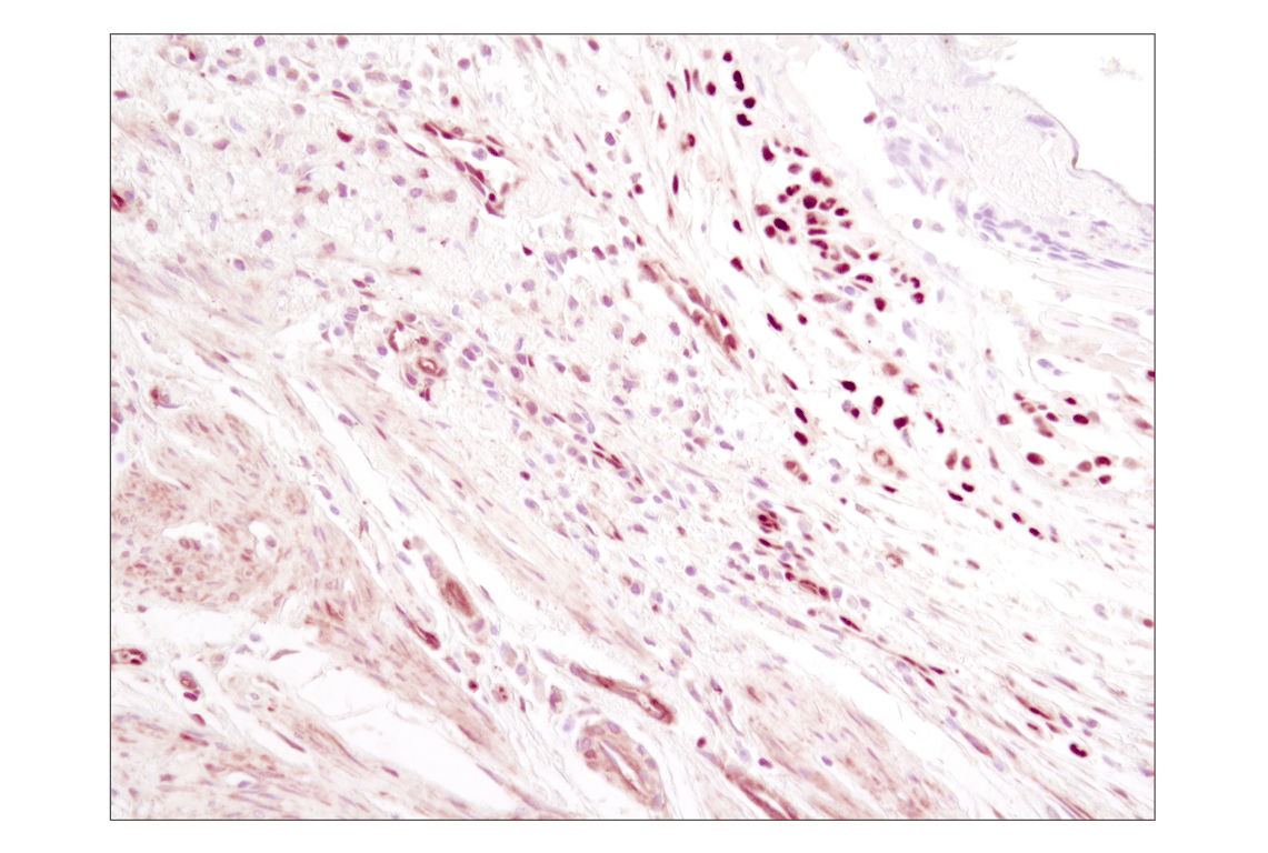 undefined Image 12: NF-kappaB p65 Antibody Sampler Kit