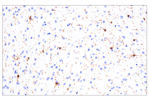 Immunohistochemistry Image 15: FcR gamma (E6Y1A) Rabbit Monoclonal Antibody
