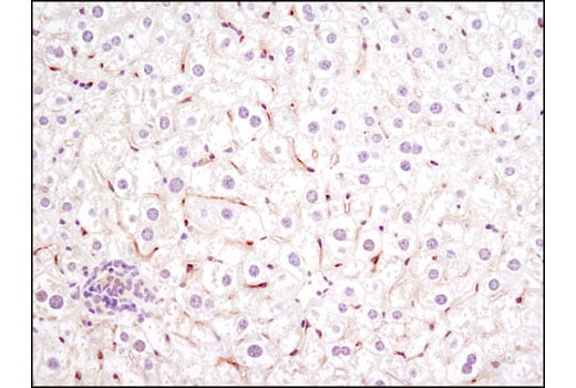 undefined Image 19: Angiogenesis Receptor Tyrosine Kinase Antibody Sampler Kit