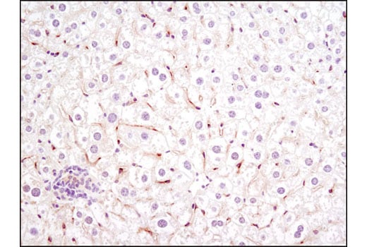 Immunohistochemistry Image 2: VEGF Receptor 2 (D5B1) Rabbit mAb